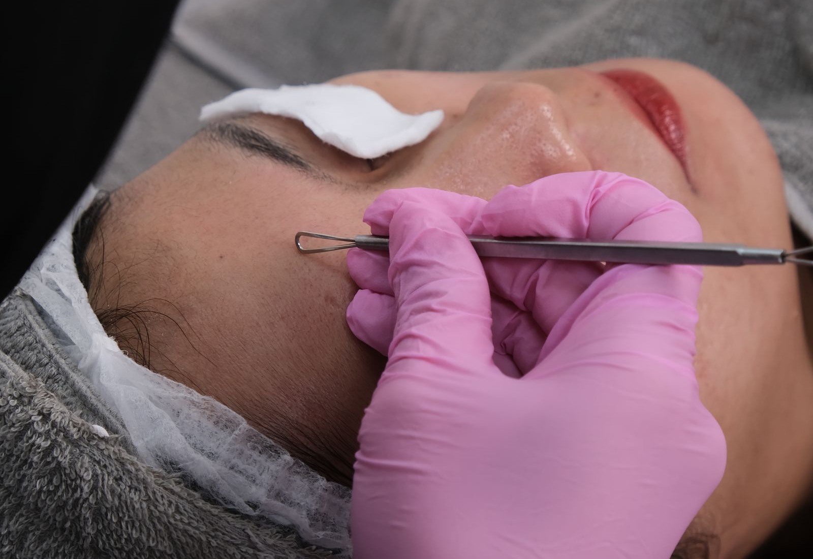 The Anti-Bacterial Facial in Bognor