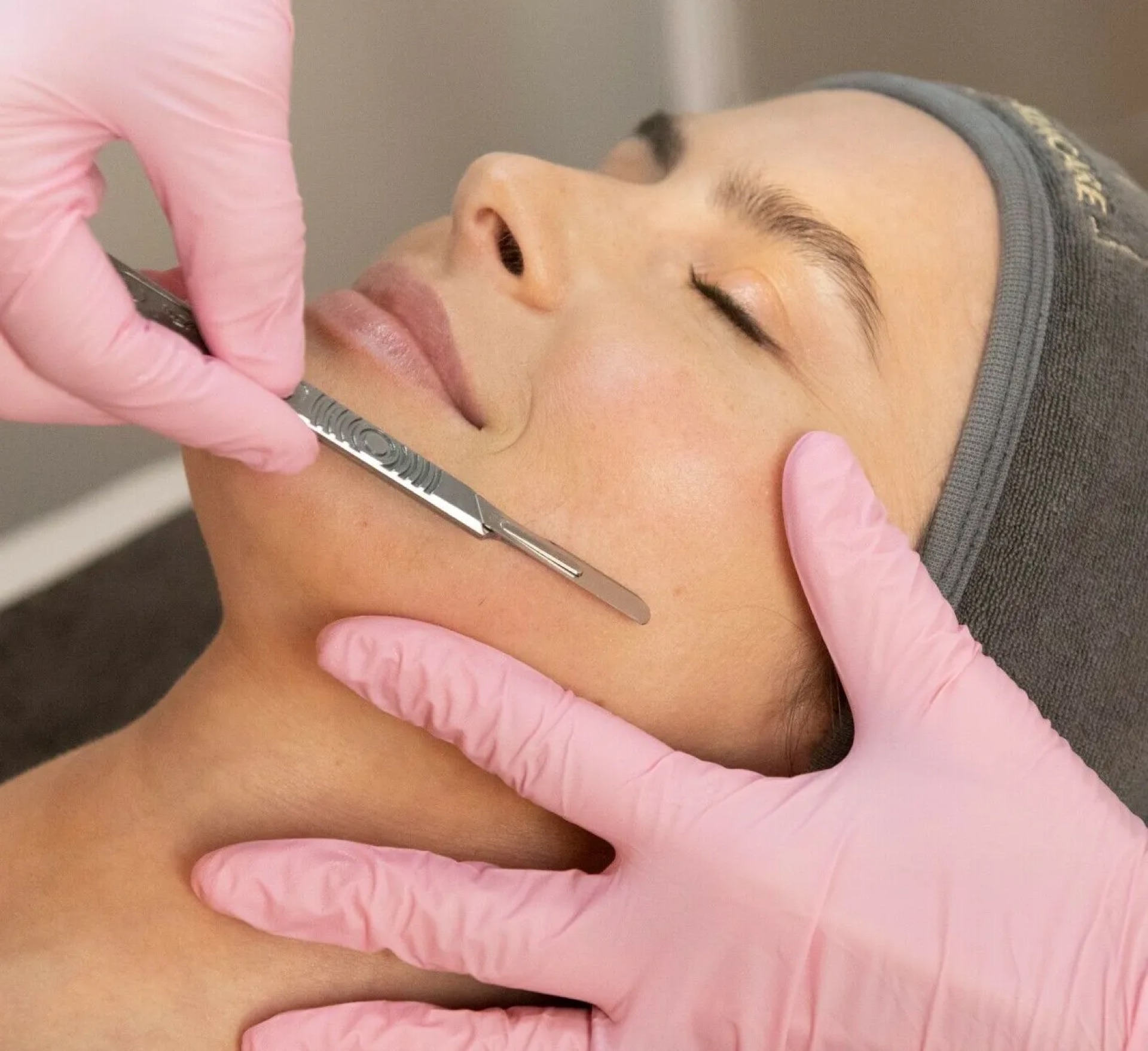 Dermaplaning