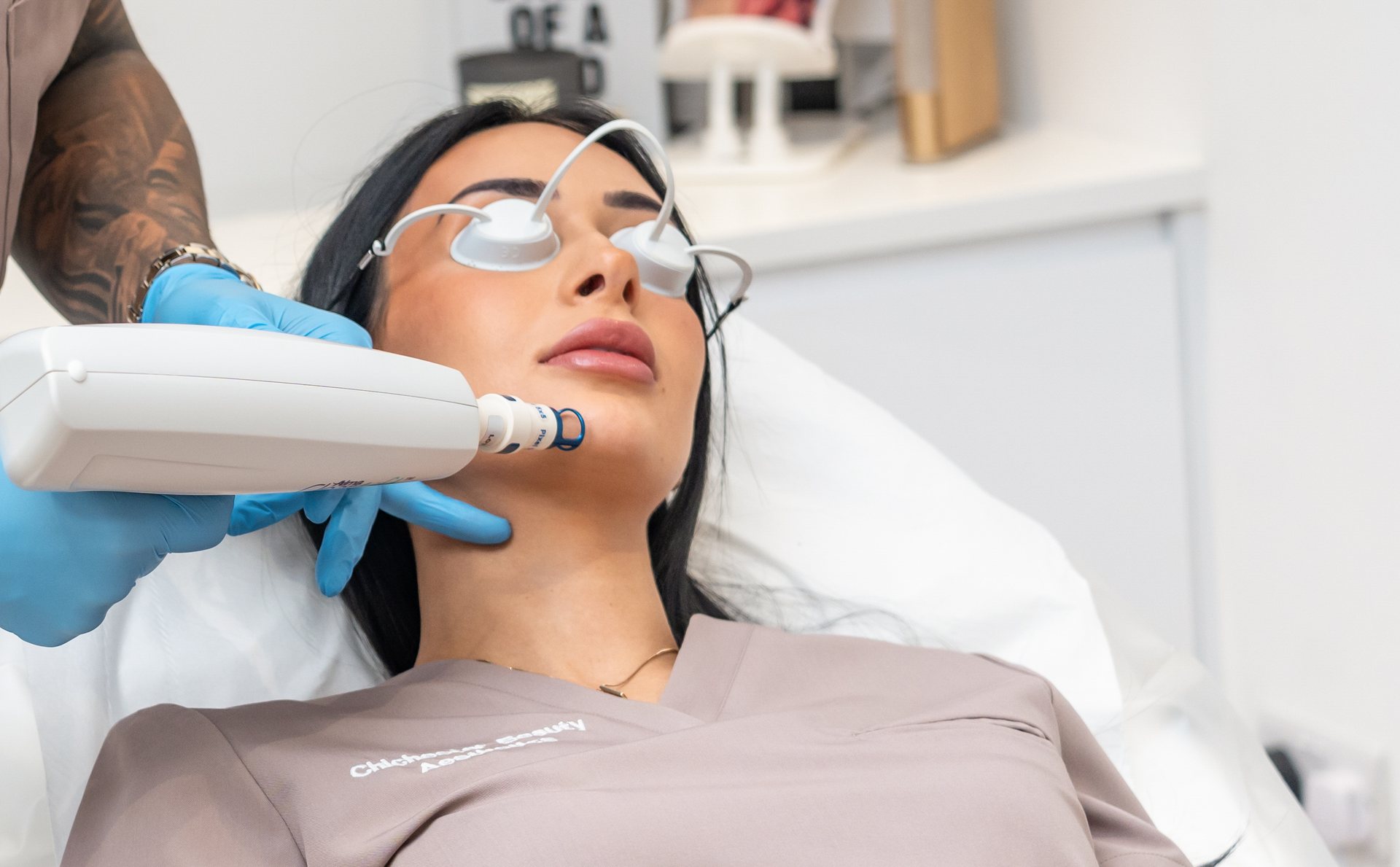Laser Thread Vein Removal in Chichester