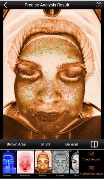 Scanner result showing areas of uneven brown tone
