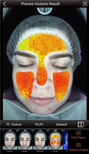 Scanner result showing skin texture as a heat map in polarised light