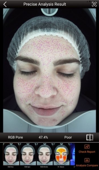 Scanner result showing pores mapped across the face in standard light