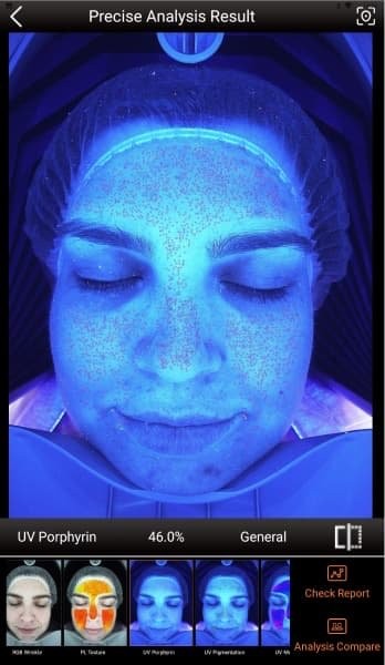 Scanner result in ultraviolet light